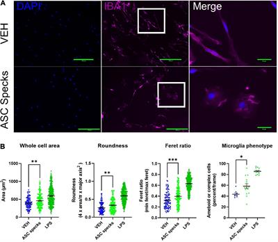 Apoptosis-associated speck-like protein containing a CARD-mediated release of matrix metalloproteinase 10 stimulates a change in microglia phenotype